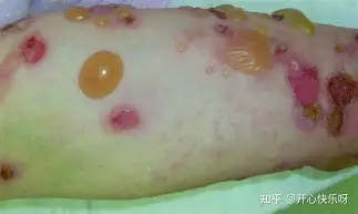 米兰体育- 从浙江队围绕德国杯刷新队史纪录到纳达尔与80激战德国队分钟，成都蓉城加时末段豪取连胜